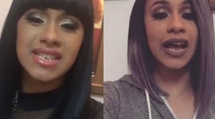 A compilation picture of Cardi B's teeth before dental surgery.